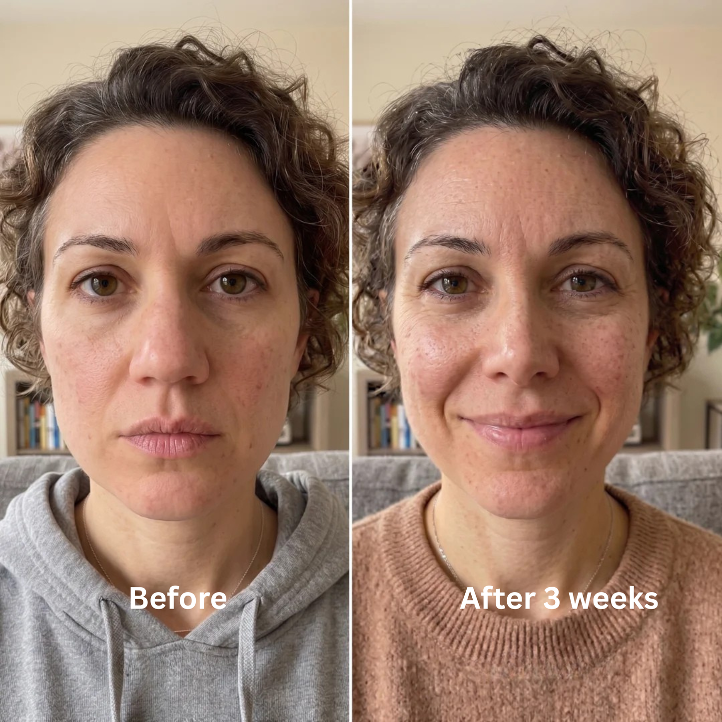 Nurela Nose Sculpt