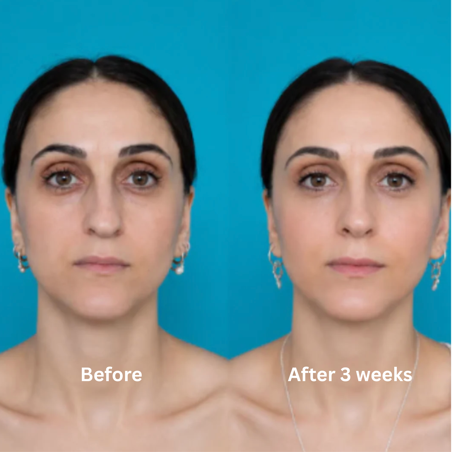 Nurela Nose Sculpt