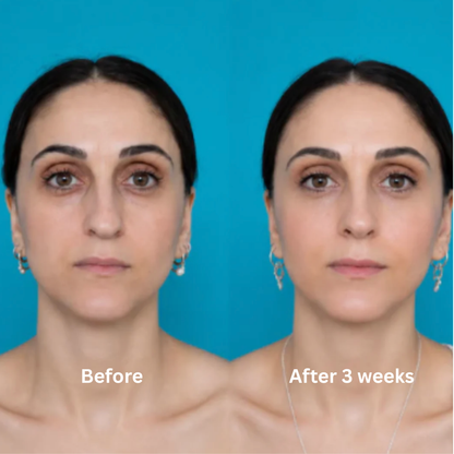 Nurela Nose Sculpt