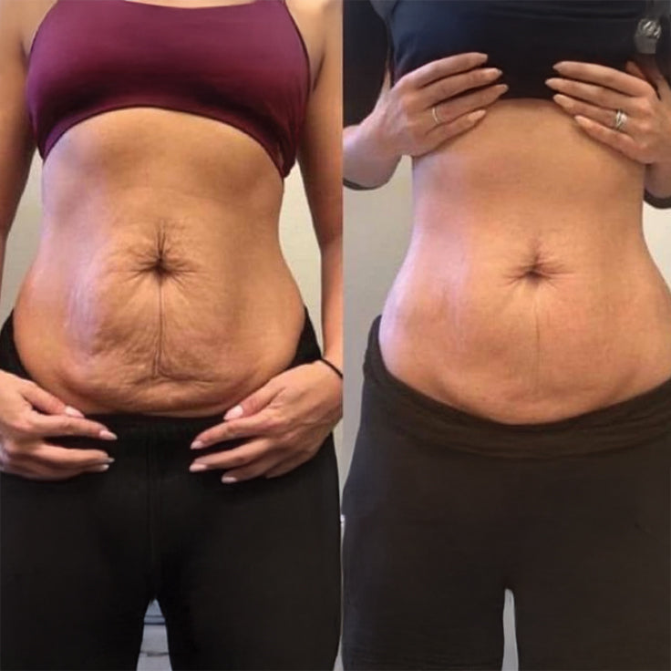 Marie before and after