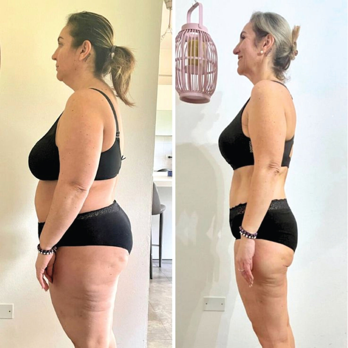 Julie before and after