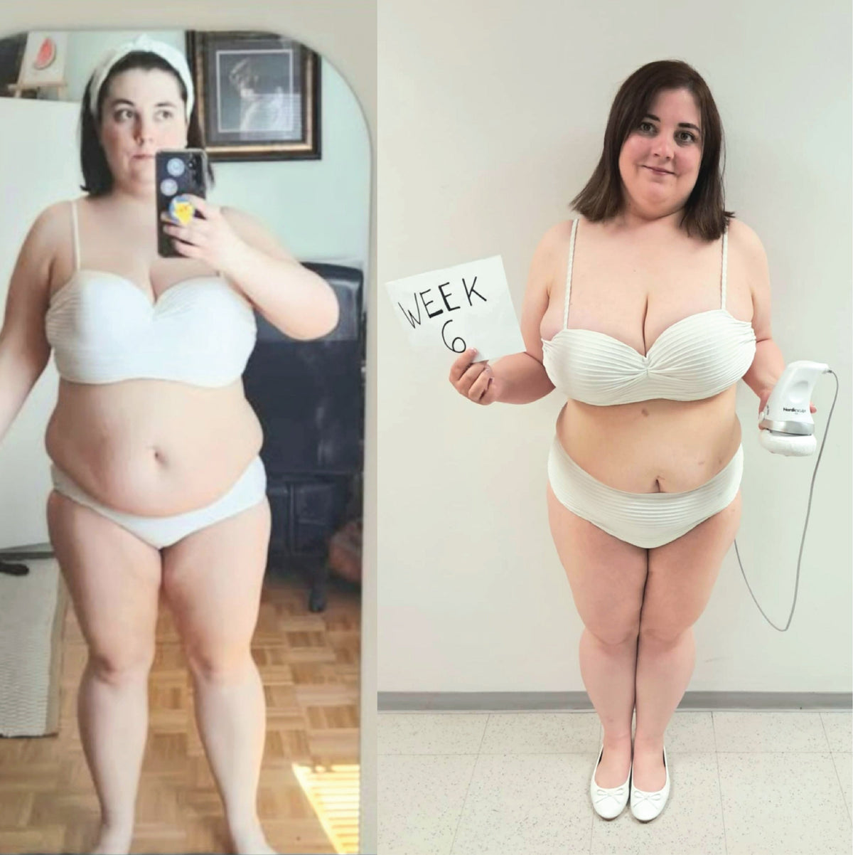 Sara before and after