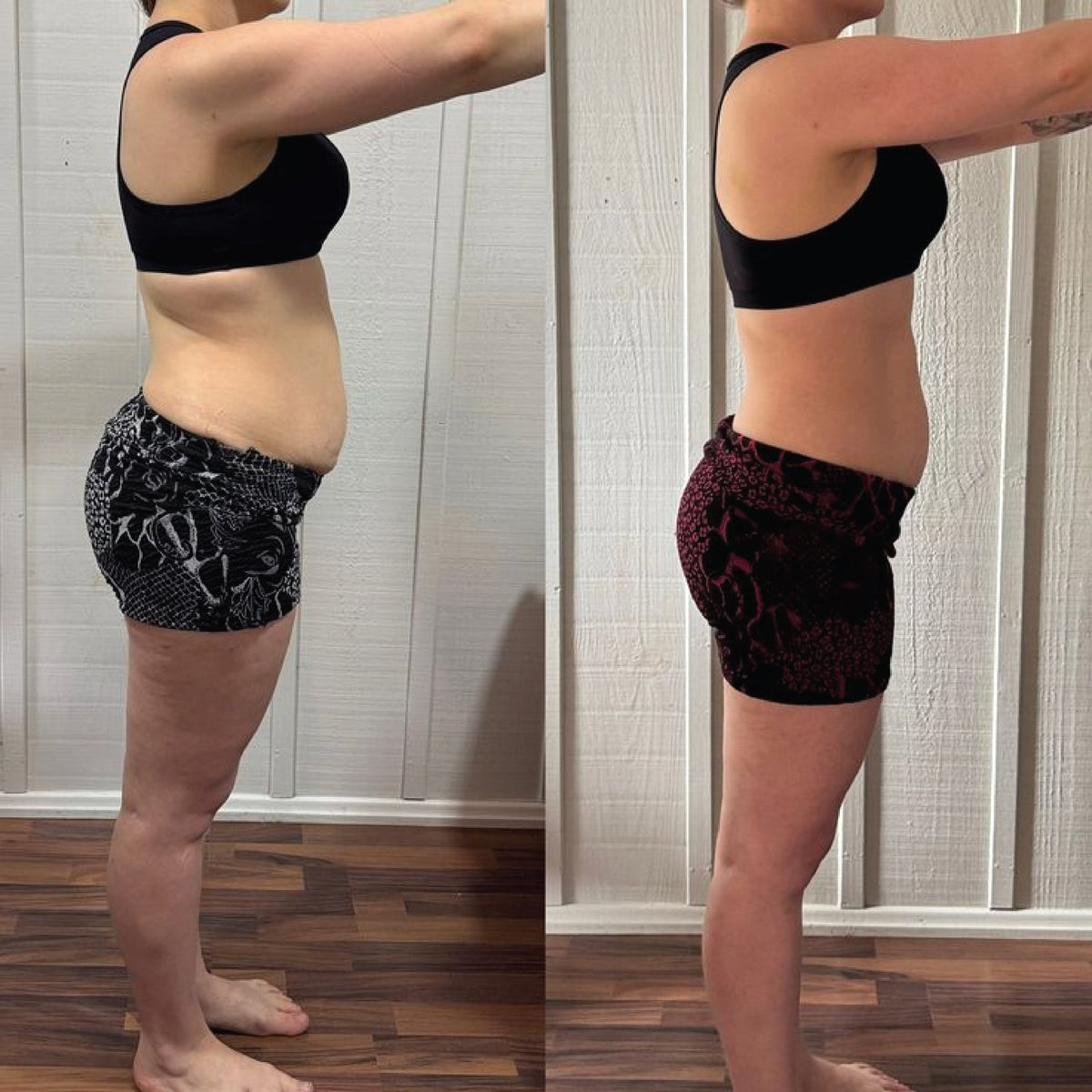Lisa before and after